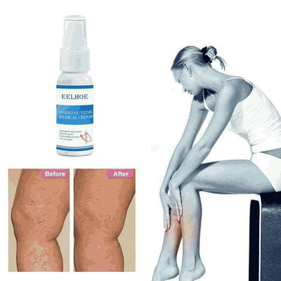 Varicose Vein Cream Spray Varicose Vein Legs and Varicose Vein Swelling L3g1 (Pack of 2)